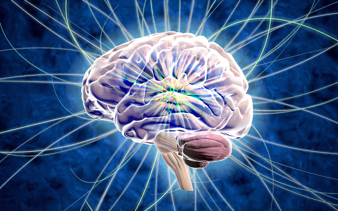 Neurointervention